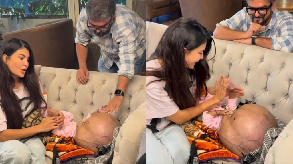 jacqueline-fernandez-visits-child-with-rare-condition--pledges-support-104851166-16x9_0